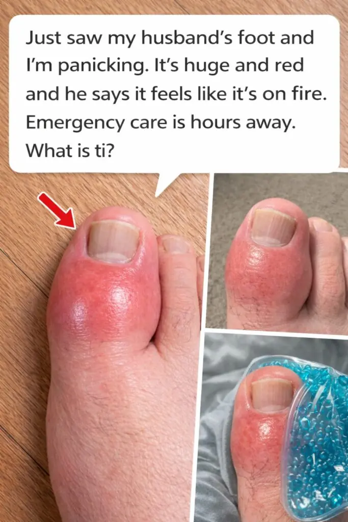 Red Swollen Burning Foot