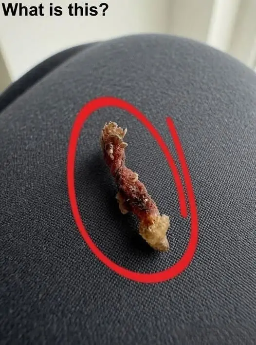 I Felt Something Crawling on My Back in Bed — But the Truth Was Much Less Terrifying