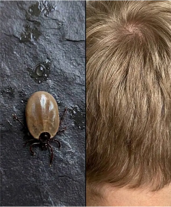 I just found it on my son's head... What is it?