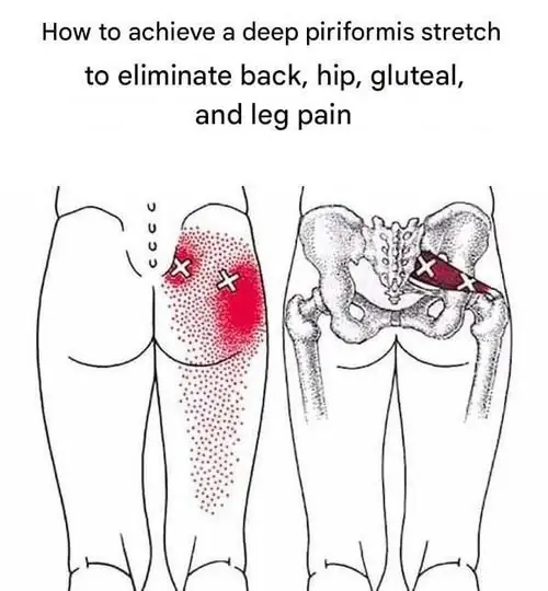 How A Deep Piriformis Stretch Can Help