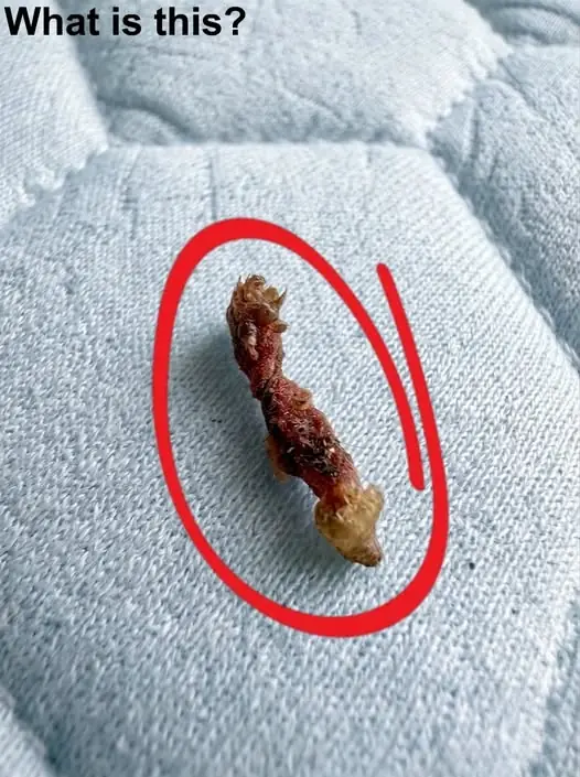 Does anyone know what this could be? And I received the results.
