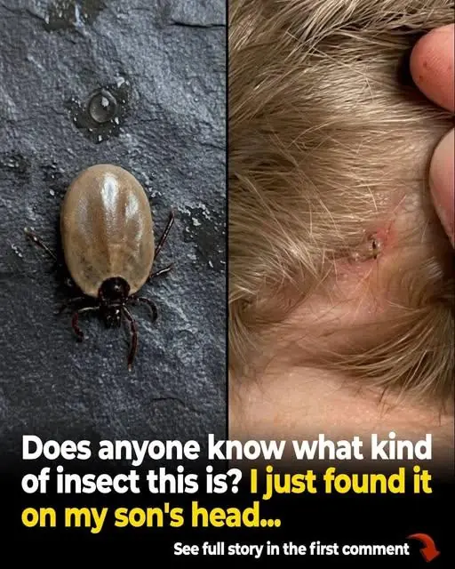 Found Something Crawling in Your Child’s Hair