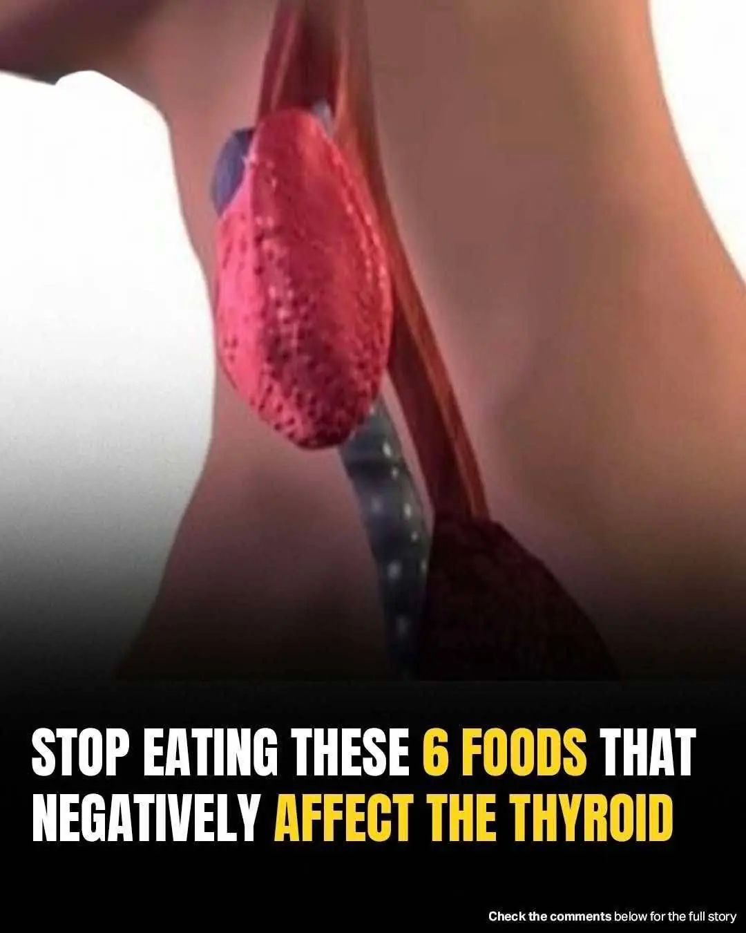 Foods That May Harm Your Thyroid Health