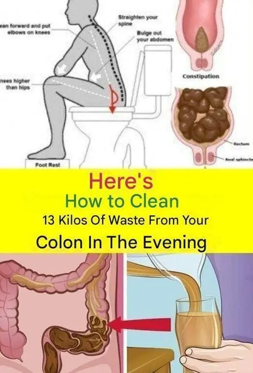 Important Health Clarification: "Clean 15kg of Waste from Your Colon Overnight" Is Not Scientifically Possible