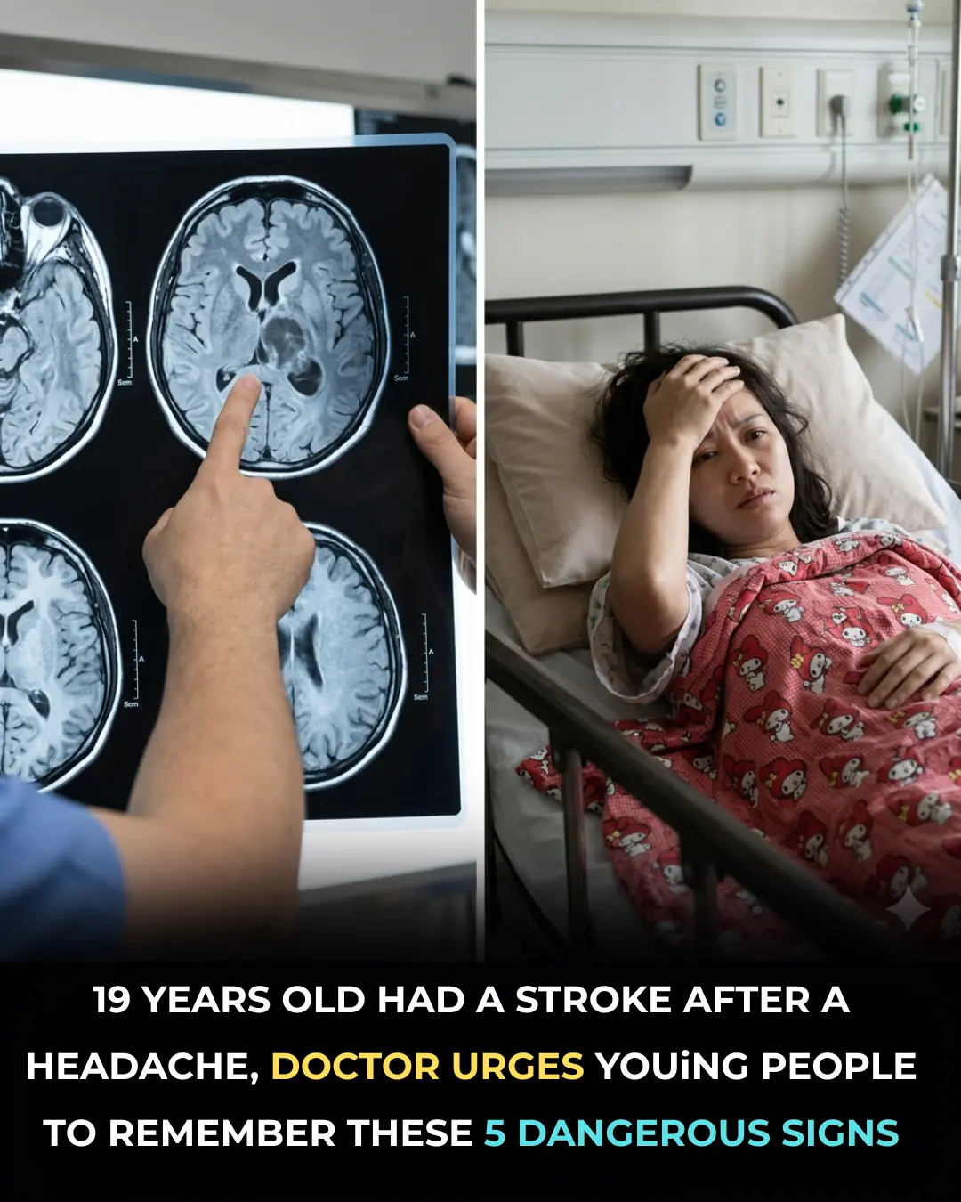 Warning signs of stroke your body might be sending