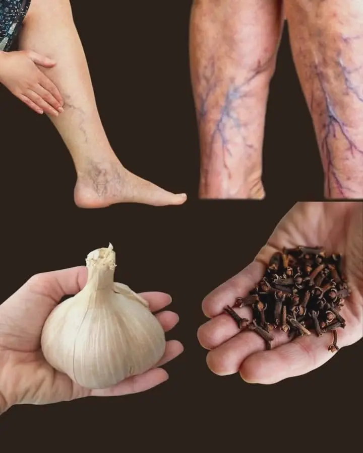 Healing Power of Garlic and Black Pepper for Leg Problems