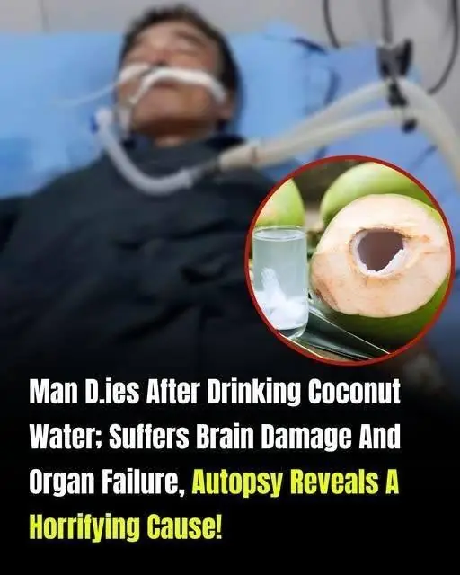 Doctors Warn: Not All Coconut Water Is Safe to Drink