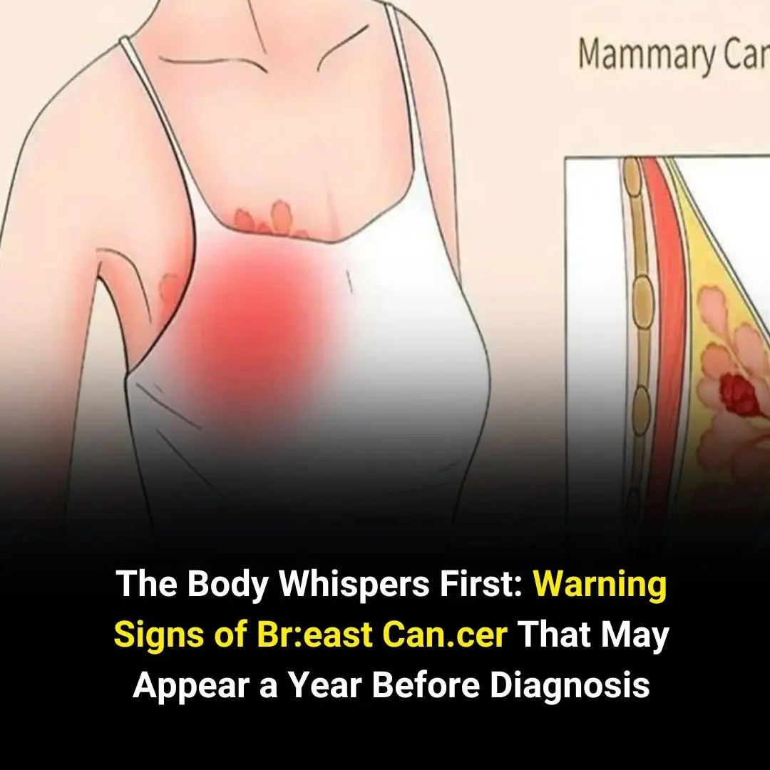 Early Breast Cancer Symptoms That Often Go Unnoticed — What Doctors Want You to Know