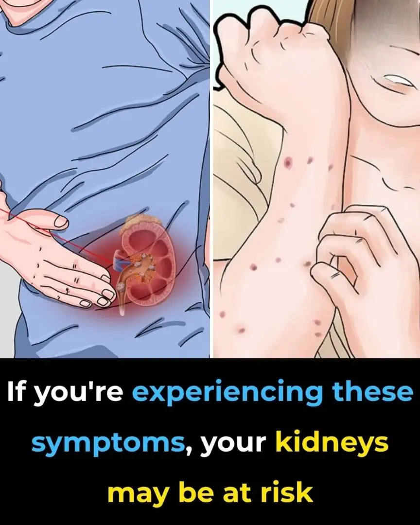 If You're Experiencing These Symptoms, Your Kidneys May Be at Risk