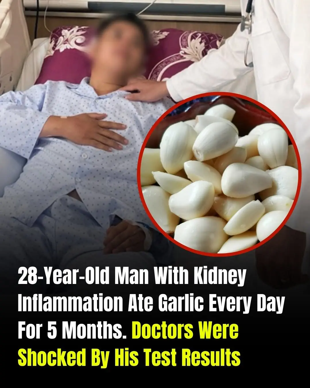 He Ate Garlic Every Day for 5 Months — What Happened to His Kidneys Surprised Doctors