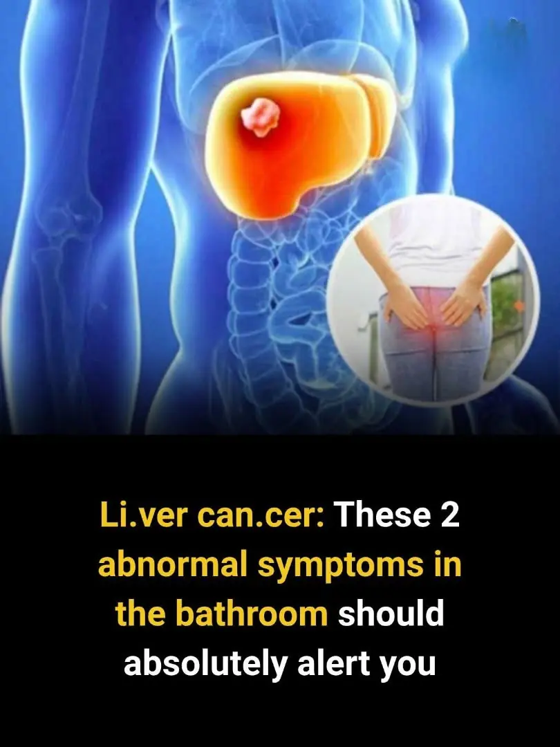 Liver Cancer: These 2 Bathroom Symptoms You Should Never Ignore