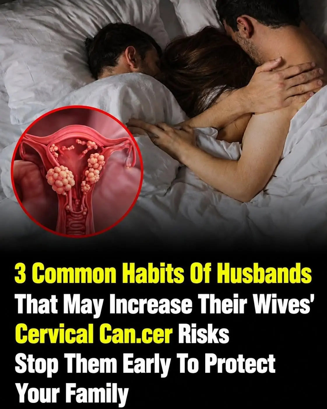 How a Husband’s Habits Can Affect His Wife’s Cervical Health