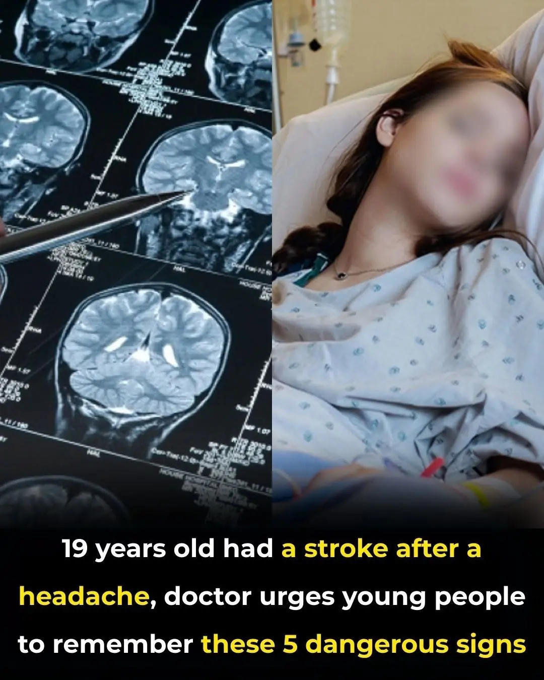 5 Alarming Stroke Warning Signs to Watch for in Young People