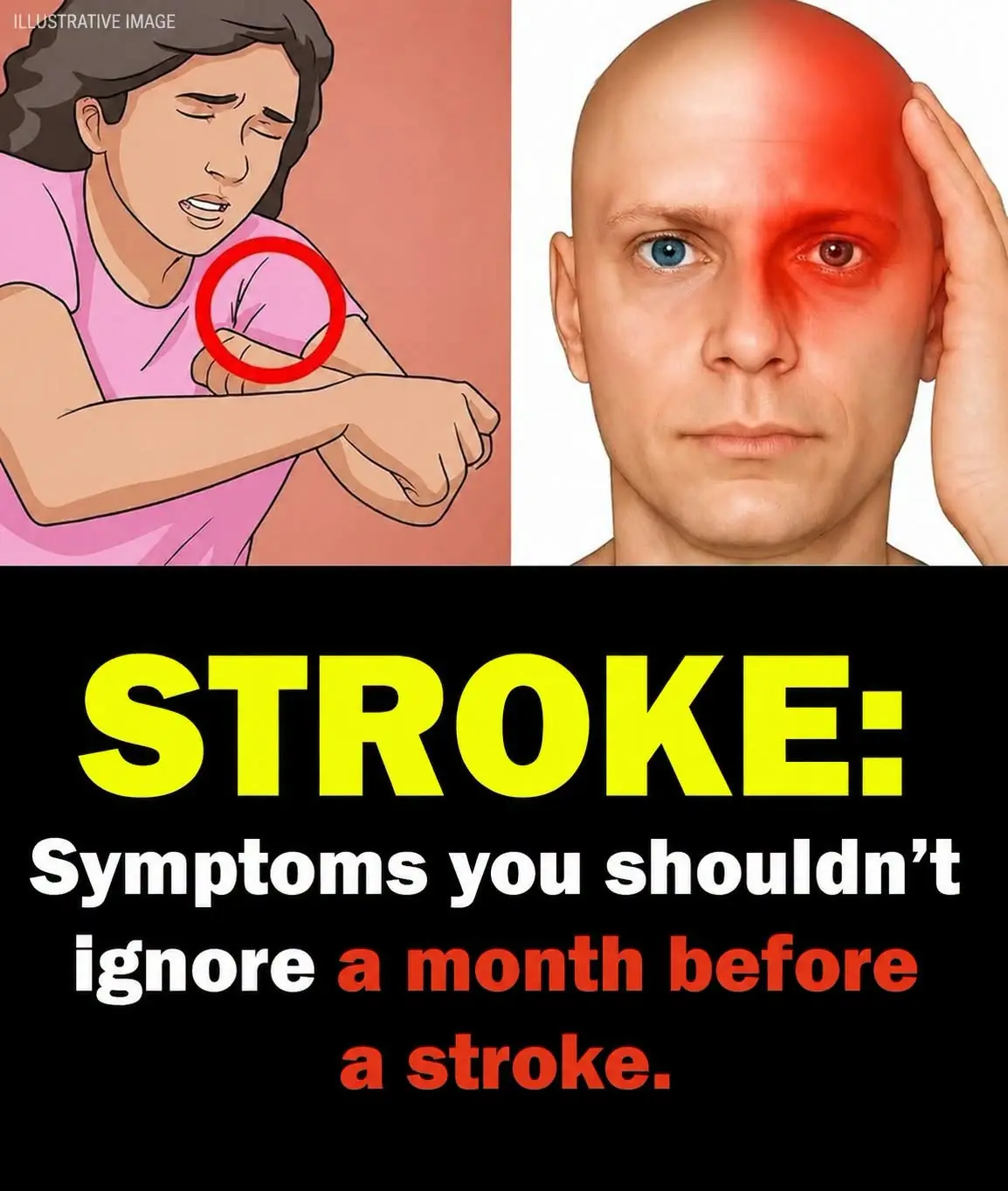 Warning Signs of a Stroke Your Body May Show