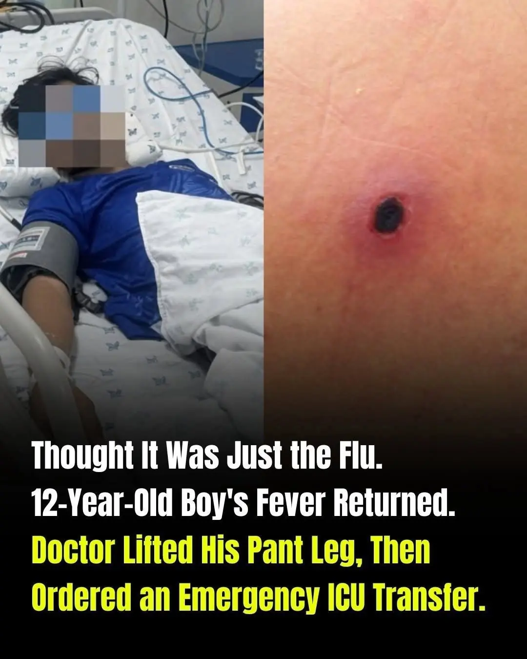 Thought It Was Just the Flu—A 12-Year-Old Boy's Fever Returned, and One Small Mark Changed Everything