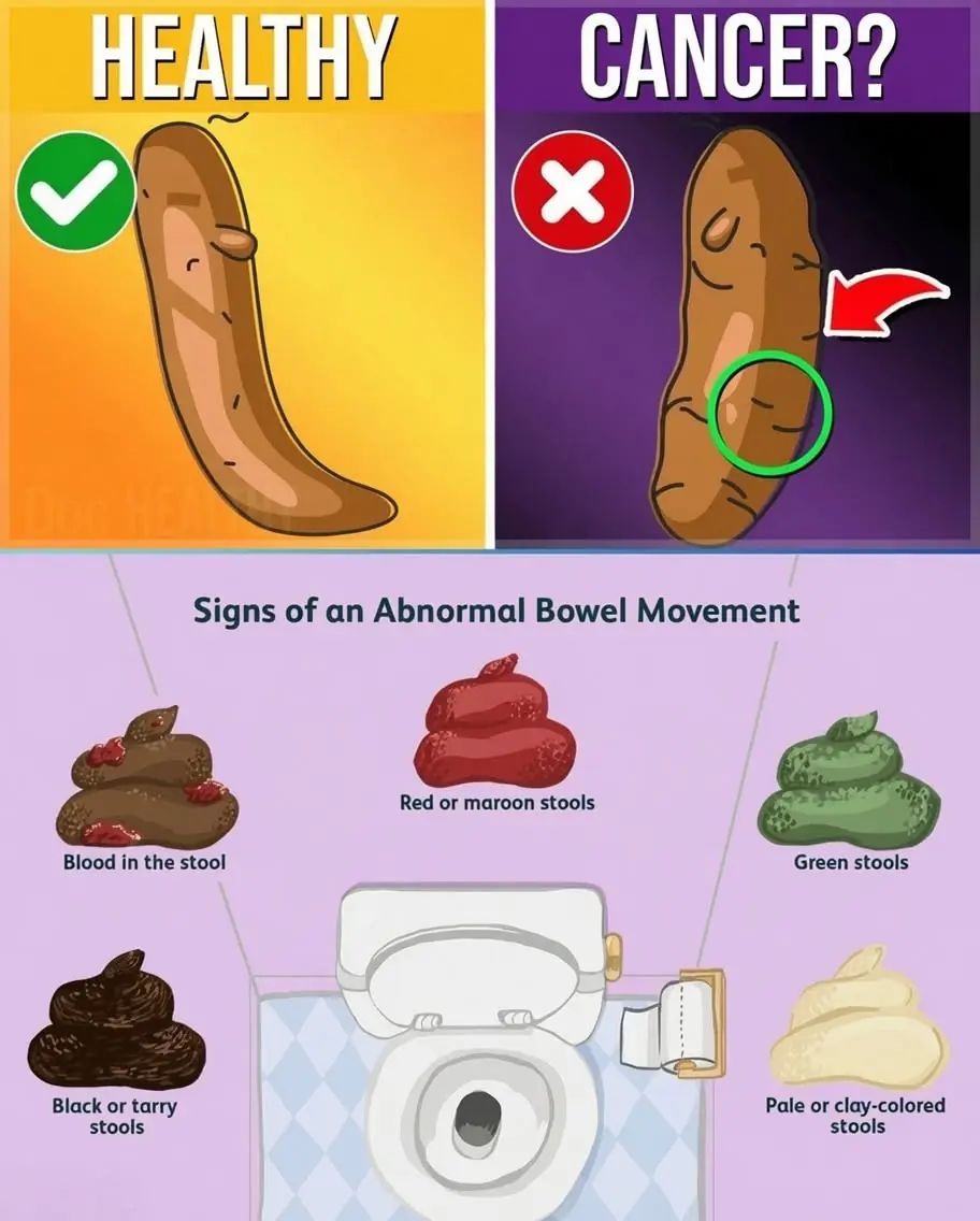Changes in Stool Color May Be Your Body's Way of Signaling Certain Health Conditions