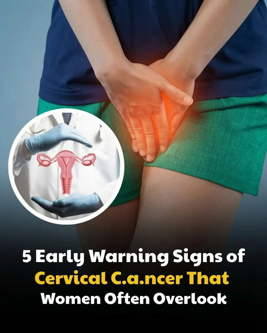 5 Early Warning Signs of Cervical Cancer That Women Often Overlook