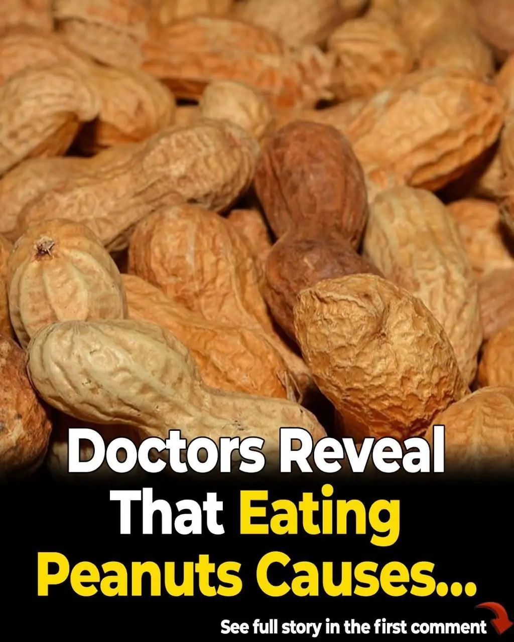 Which Nuts Nourish Your Brain? 4 to Avoid and 4 to Eat
