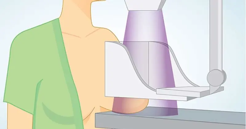 Japan has a Lower Rate of Breast Cancer than the U.S. – This Nutrient Makes the Difference