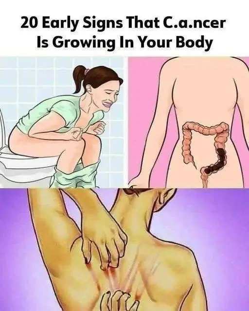 Your Body May Be Sending Warning Signals—20 Signs Worth Paying Attention To