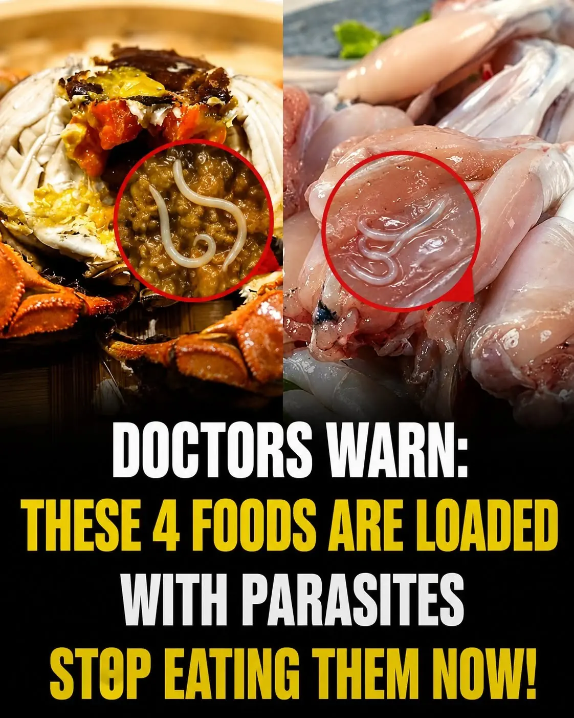 Doctors Warn: Stop Eating These 4 Foods Immediately—They May Carry Hidden Parasites That Put Your Health at Risk