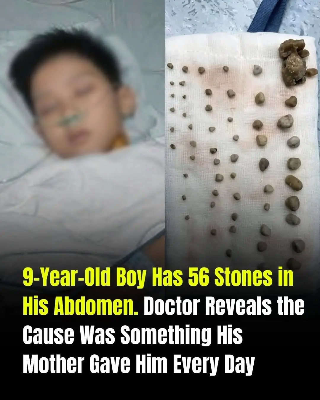 A 9-Year-Old Boy's Mysterious Stones: Why Children's Daily Habits Matter for Kidney and Urinary Health