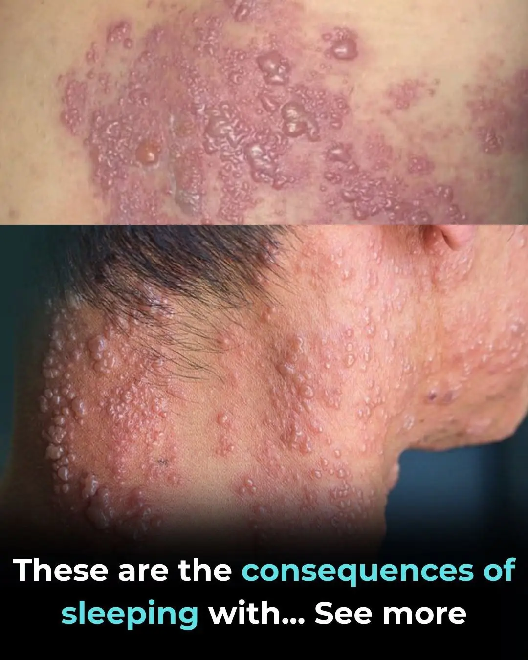 These are the consequences of sleeping with the…