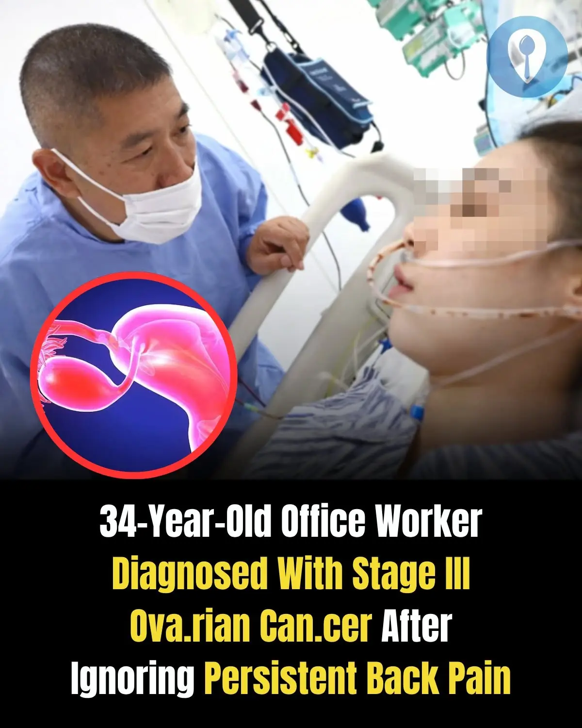 34-Year-Old Office Worker Diagnosed With Stage III Ova.rian Can.cer After Ignoring Persistent Back Pain