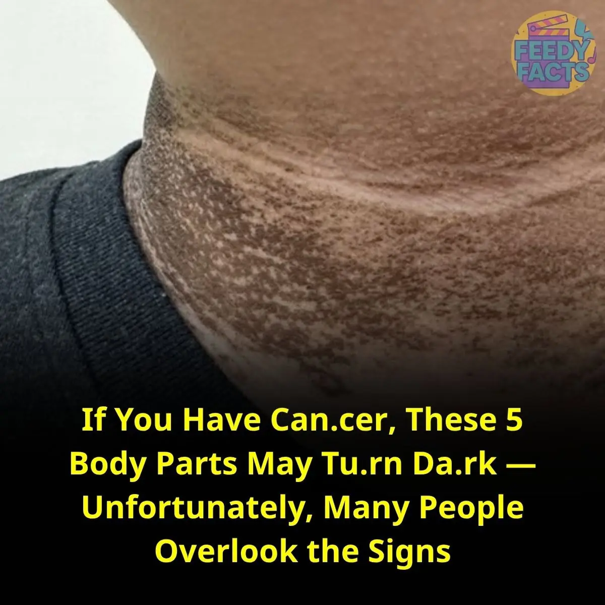 If You Have Can.cer, These 5 Body Parts May Tu.rn Da.rk — Unfortunately, Many People Overlook the Signs