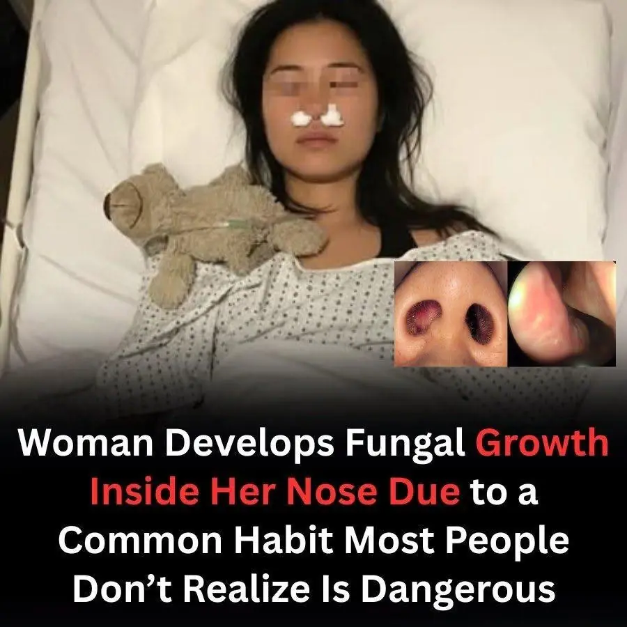 Woman Develops Fungal Growth Inside Her Nose Due to a Common Habit Most People Don’t Realize Is Dangerous
