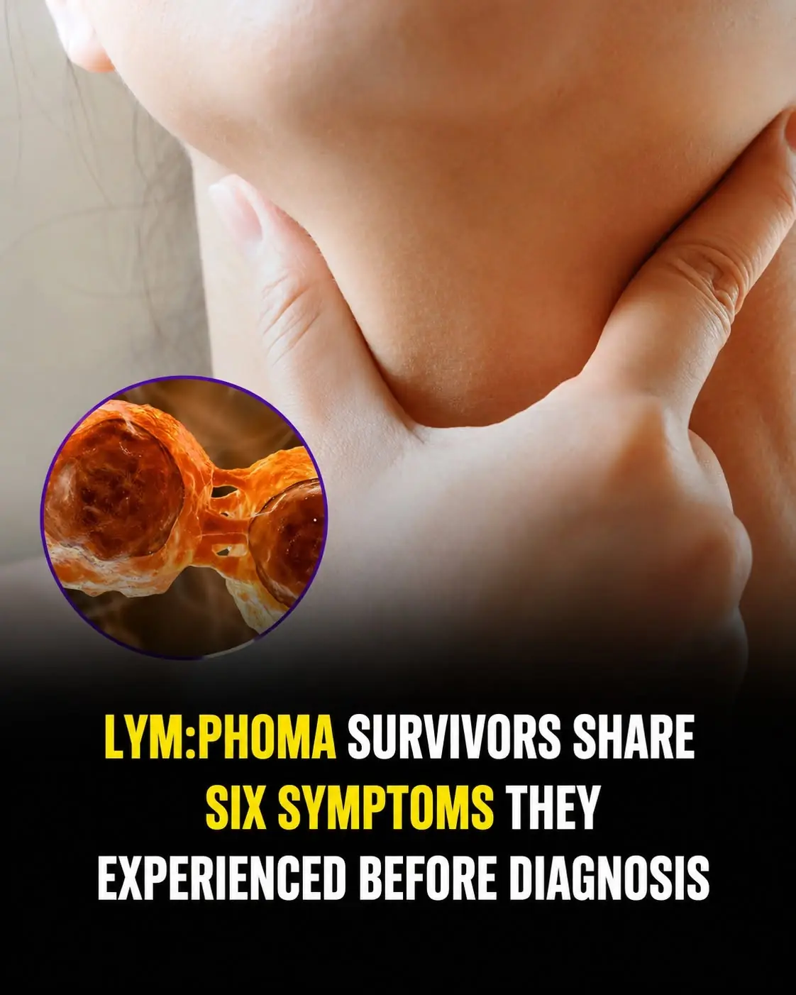 6 Symptoms Reported by Lym.phoma Survivors Before Diagnosis That Should Never Be Ignored
