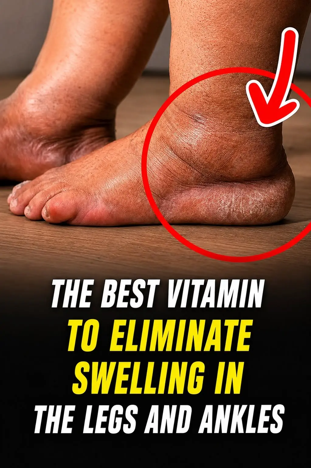 The Best Vitamin to Help Reduce Swollen Legs and Ankles: What You Need to Know