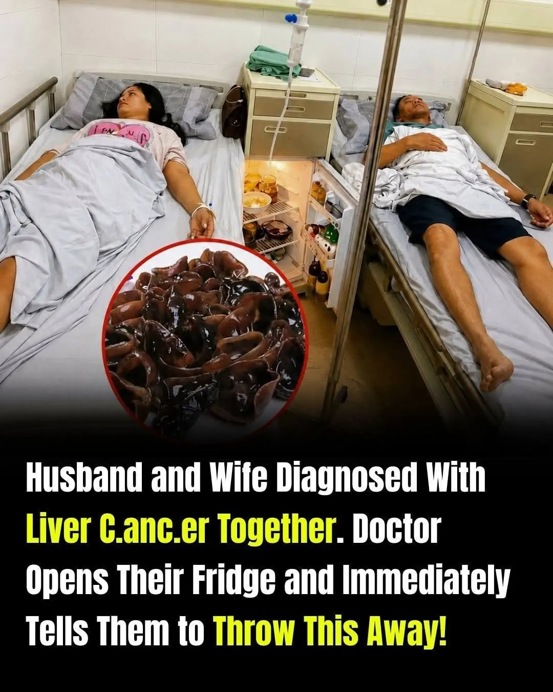 Couple Diagnosed with Liver Cancer: Why Proper Food Storage Matters More Than You Think
