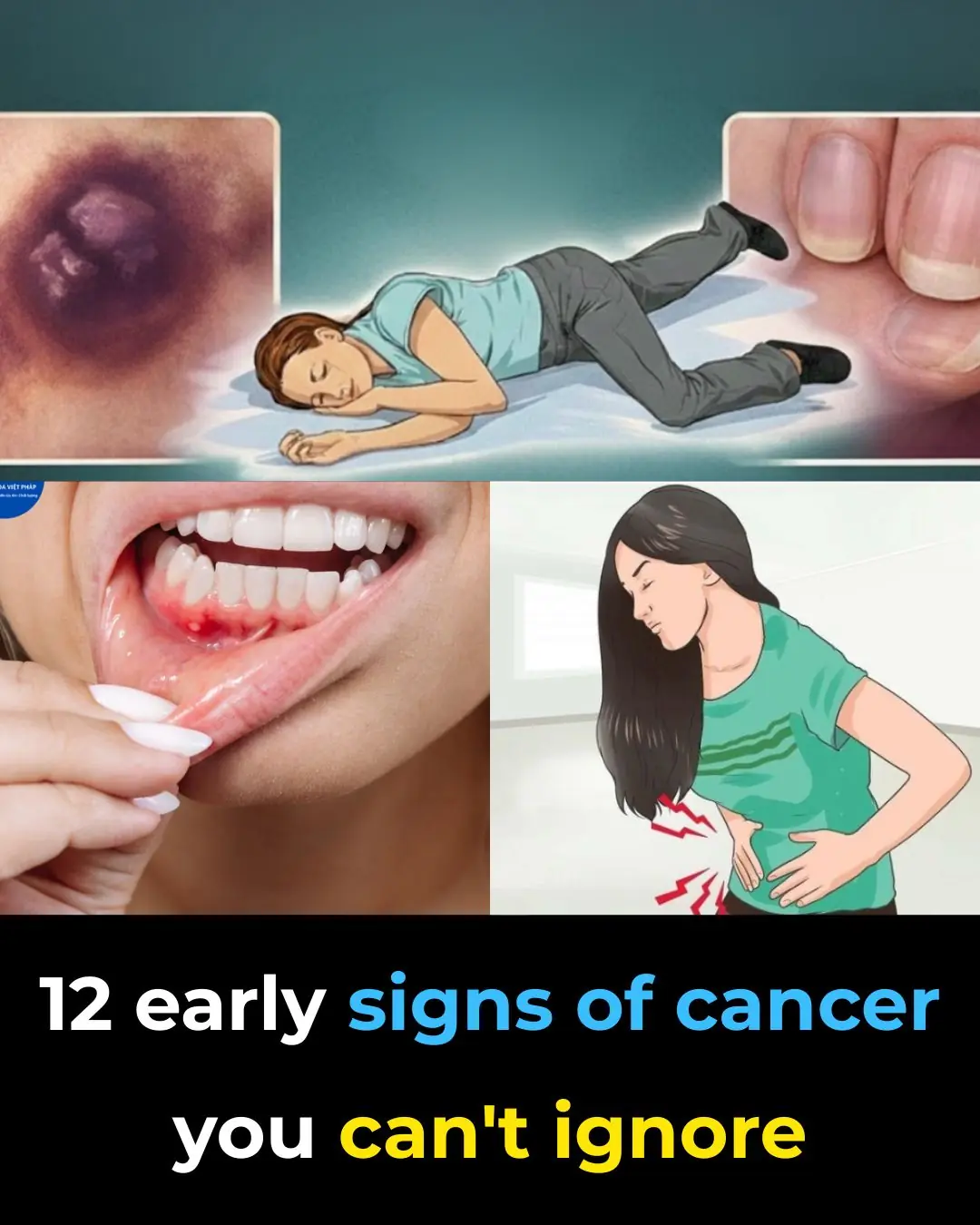 12 Early Warning Signs of Cancer You Should Never Ignore