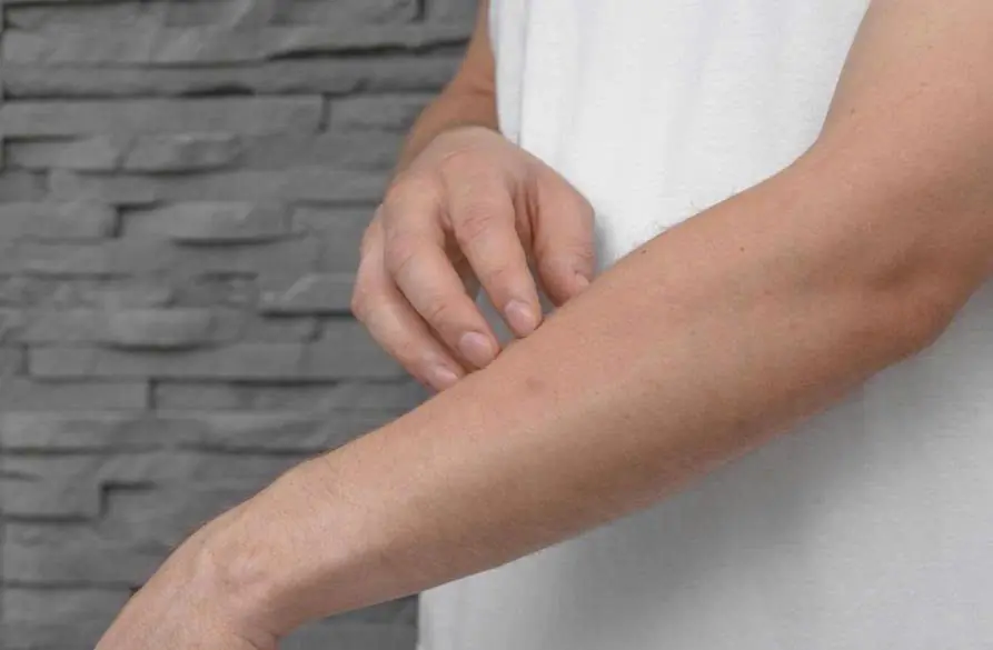 These 9 Types of Persistent Itching May Be Warning Signs of Serious Health Problems - Including Can.cer