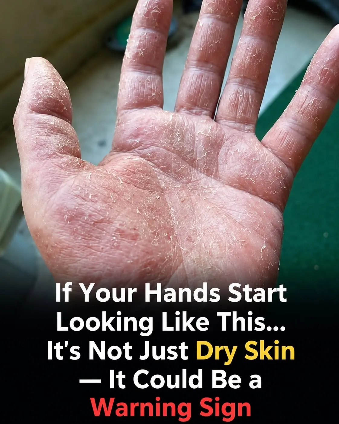 If the Skin on Your Hands Looks Like This, Your Body May Be Trying to Warn You