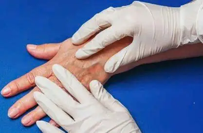What Do Visible Veins on Your Hands Really Mean? Here's What Experts Say