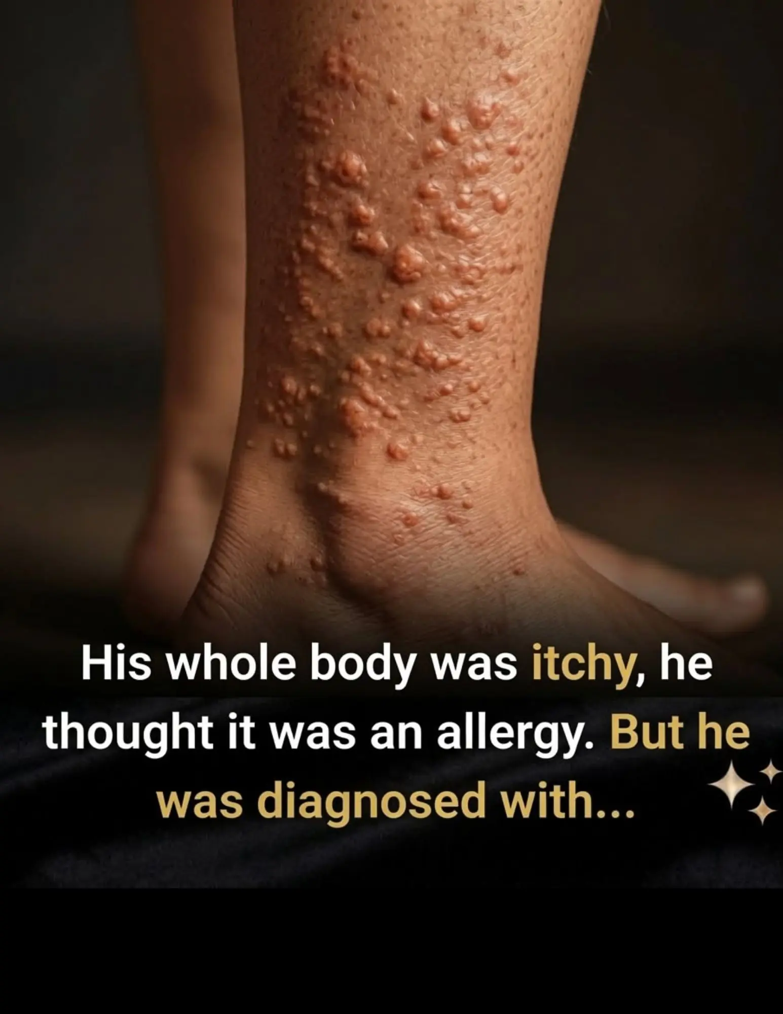 He Ignored What Looked Like an Allergy - Until Doctors Found the Real Cause