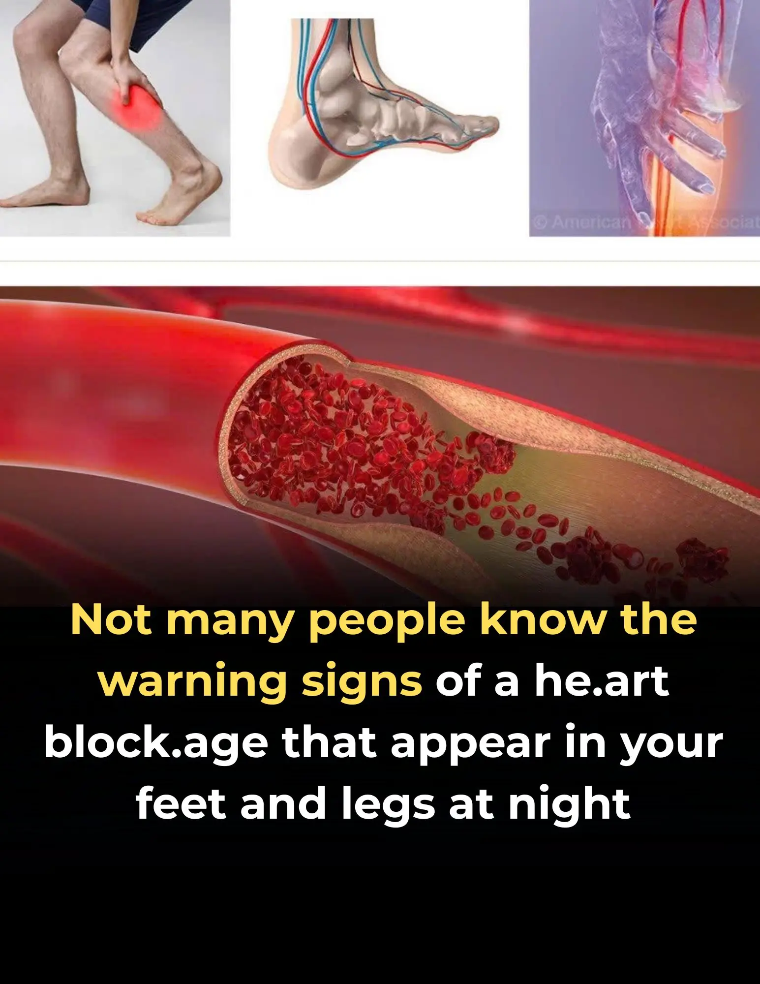 What Your Feet and Legs May Be Telling You at Night