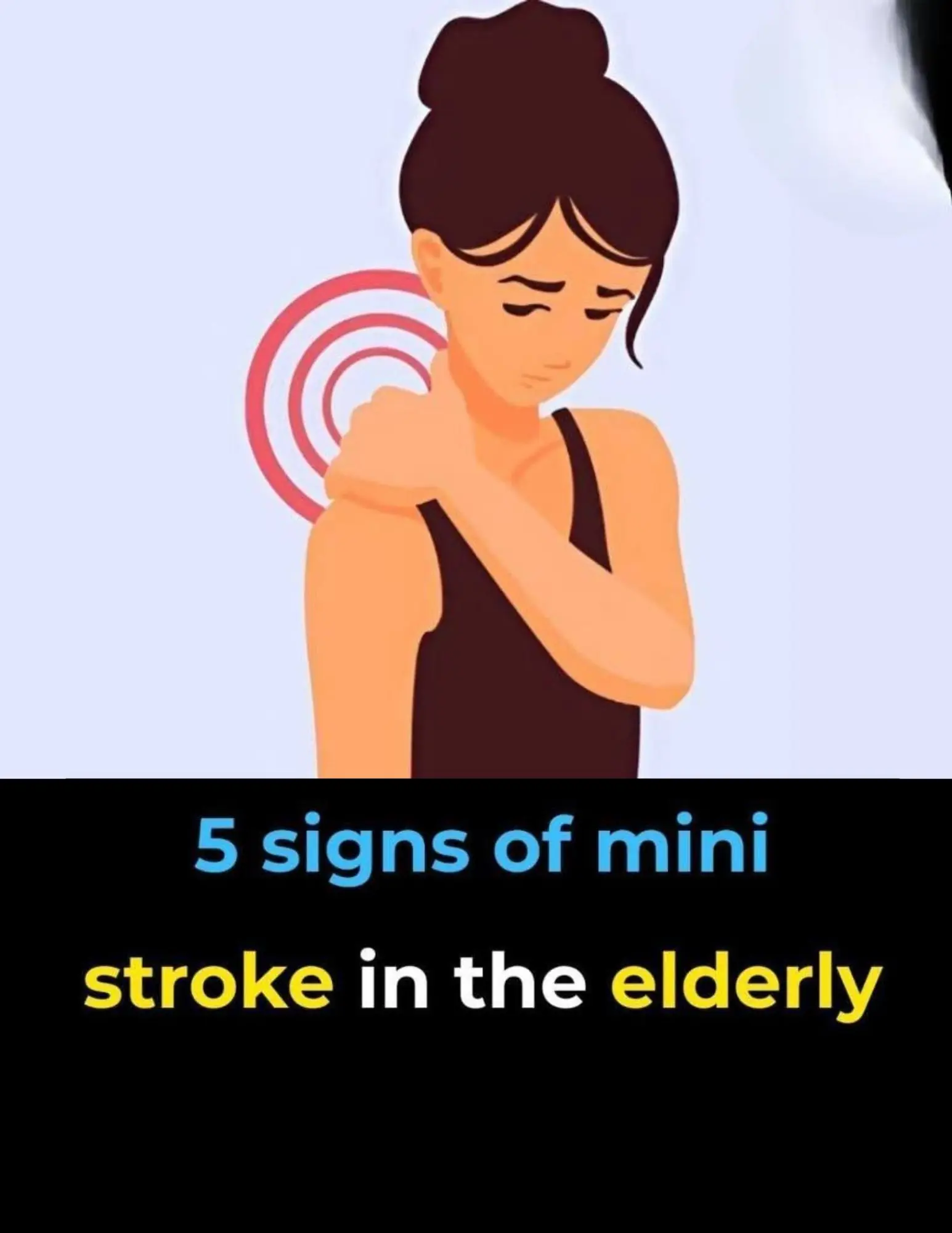 These 5 Symptoms May Signal a Transient Ischemic Attack (TIA) in Older Adults