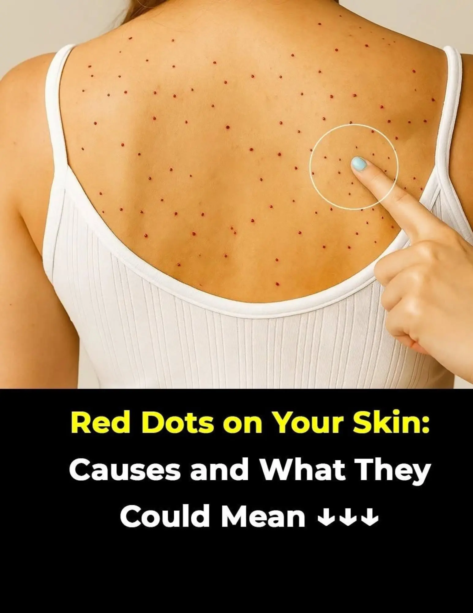 Red Dots on the Skin Can Have Many Causes – Here's What You Should Know