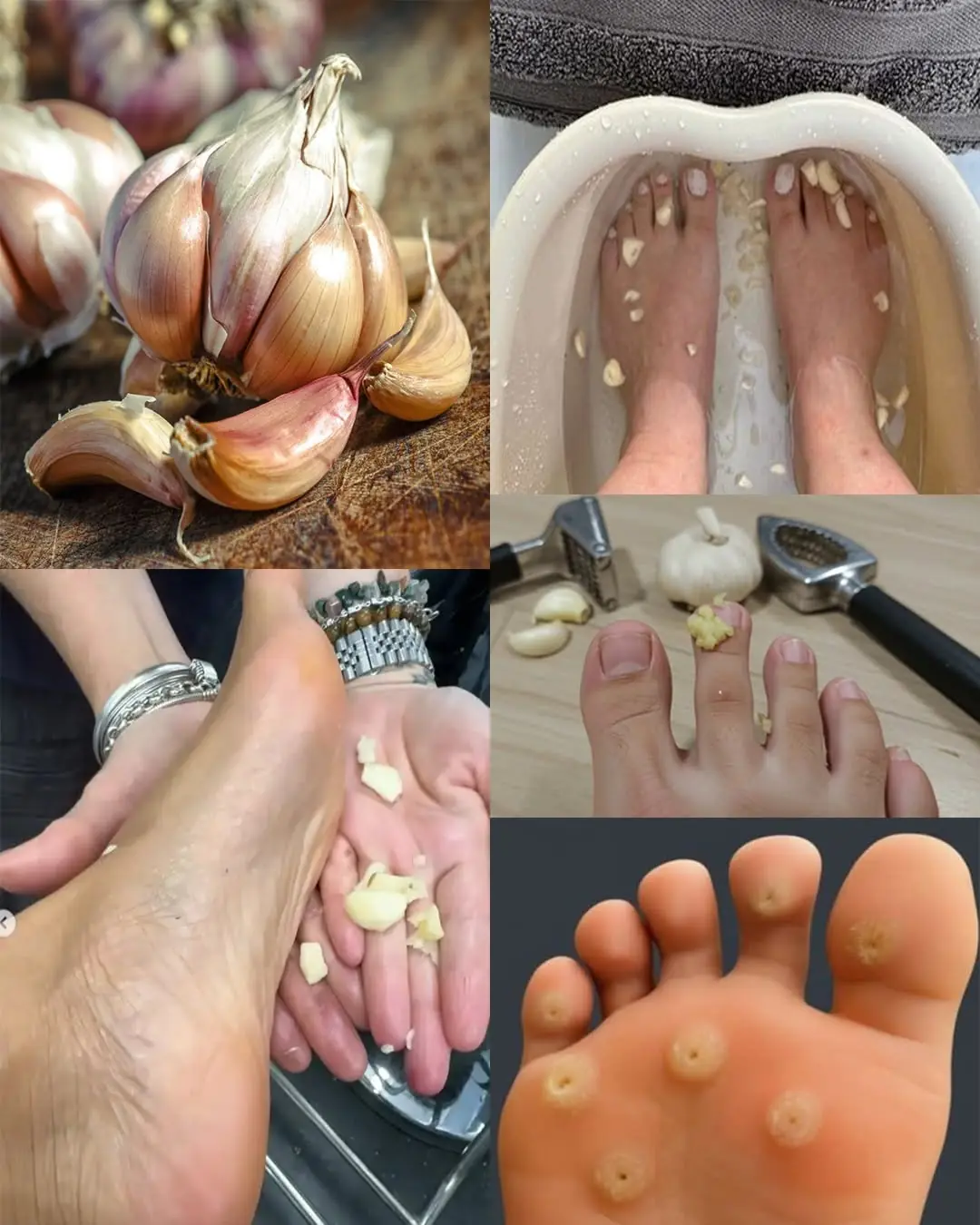 The Remarkable Power of Garlic for Foot Health: Benefits and Homemade Uses