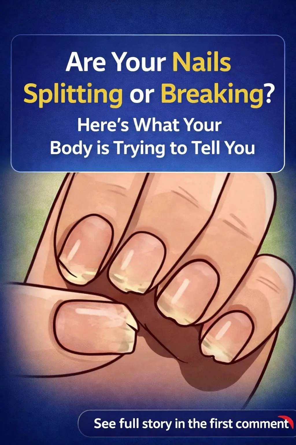 These 9 Nail Changes Could Be Signs of Underlying Health Issues