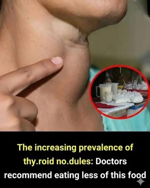 The rising number of thy.roid no.dules has doctors advising people to cut back on this particular food