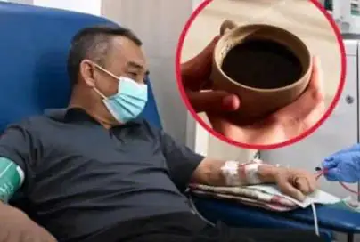 Coffee and Kidney Health: What You Need to Know Before It’s Too Late