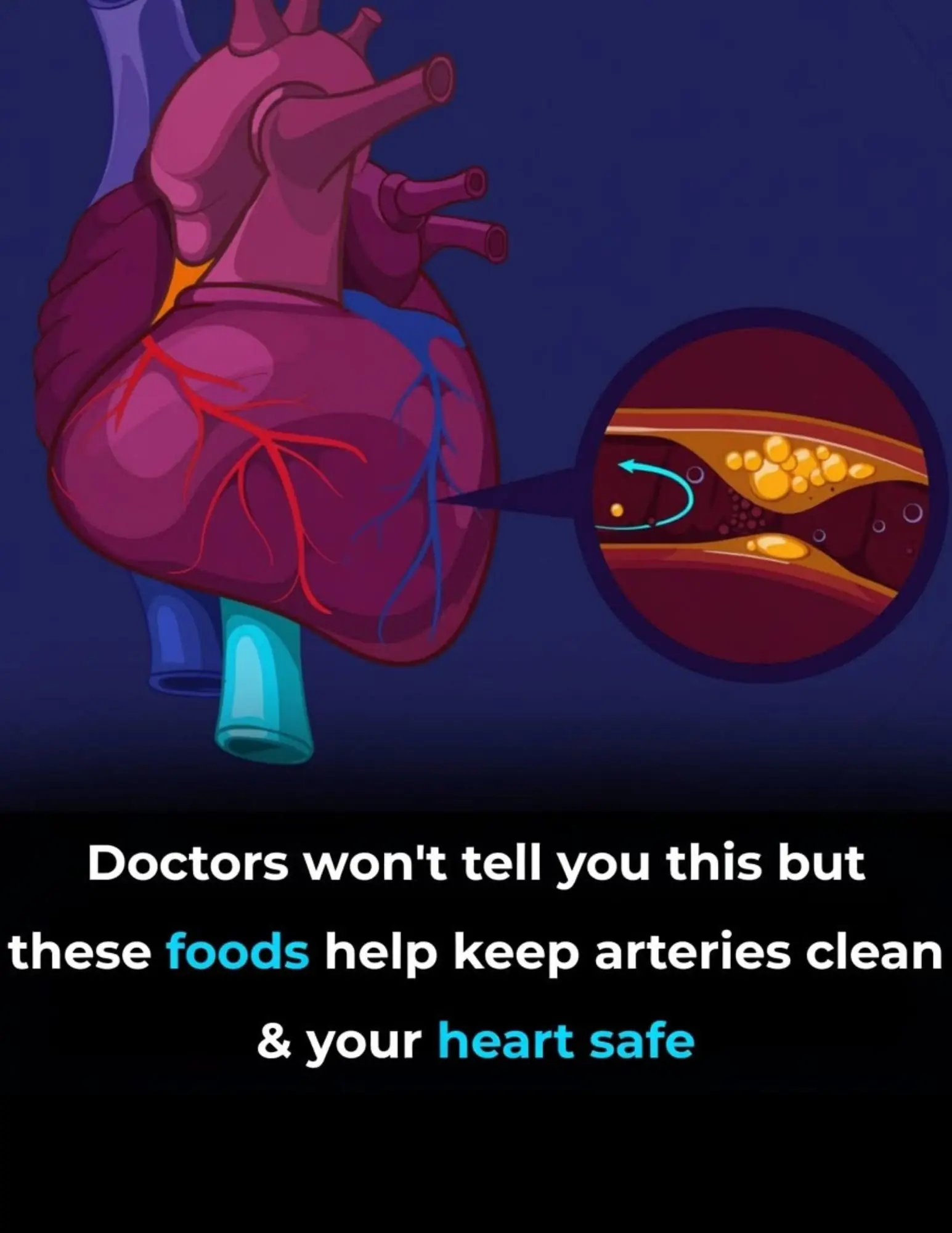 Want Healthier Arteries? Start Adding These Foods to Your Plate