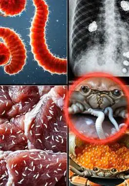 Doctors Alert: Stop Eating These Four Foods Right Away: They're OfTean Linked To Para Sites psss