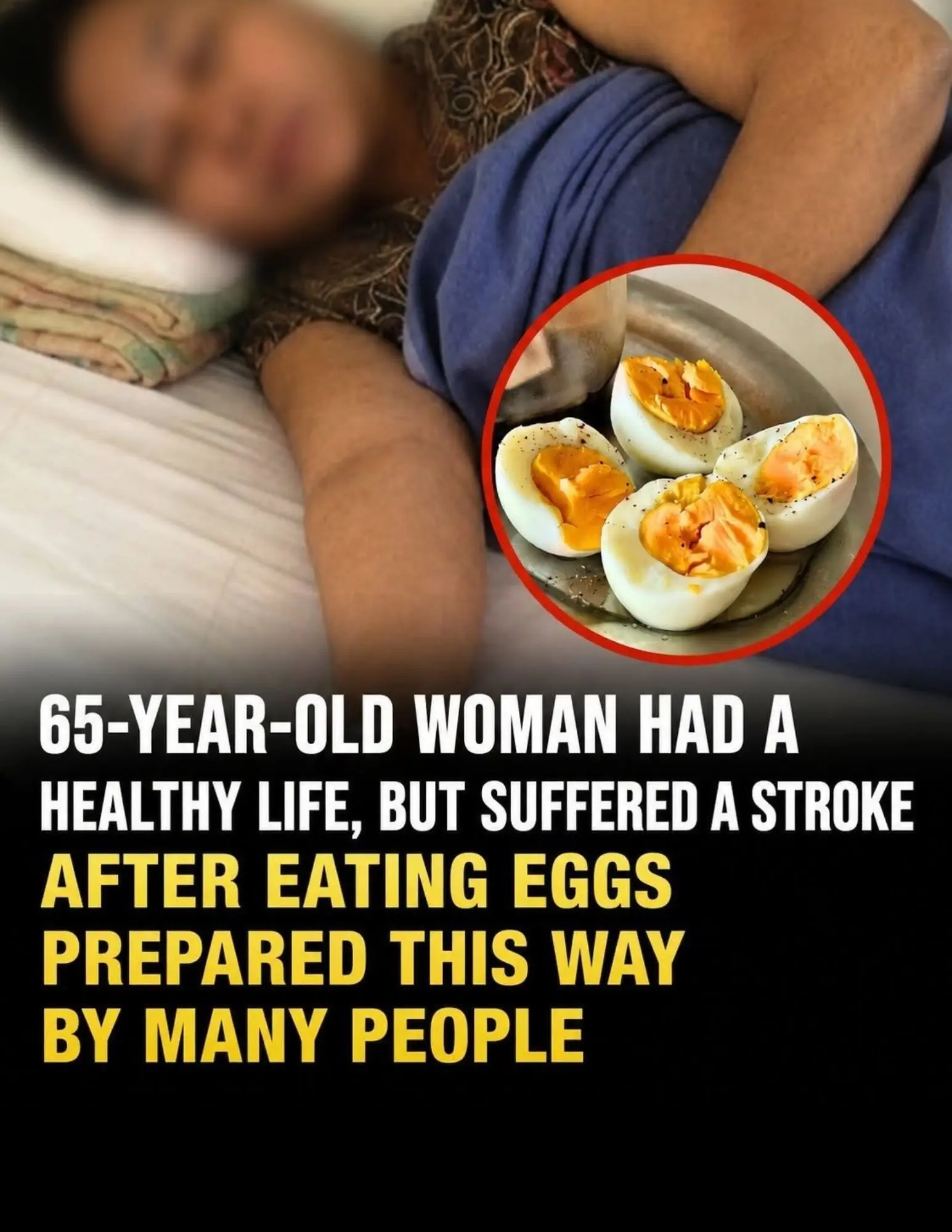 A 65-Year-Old Woman Suffered a Stroke After Eating Eggs This Way Every Day: The Hidden Food Safety Mistake Many People Overlook