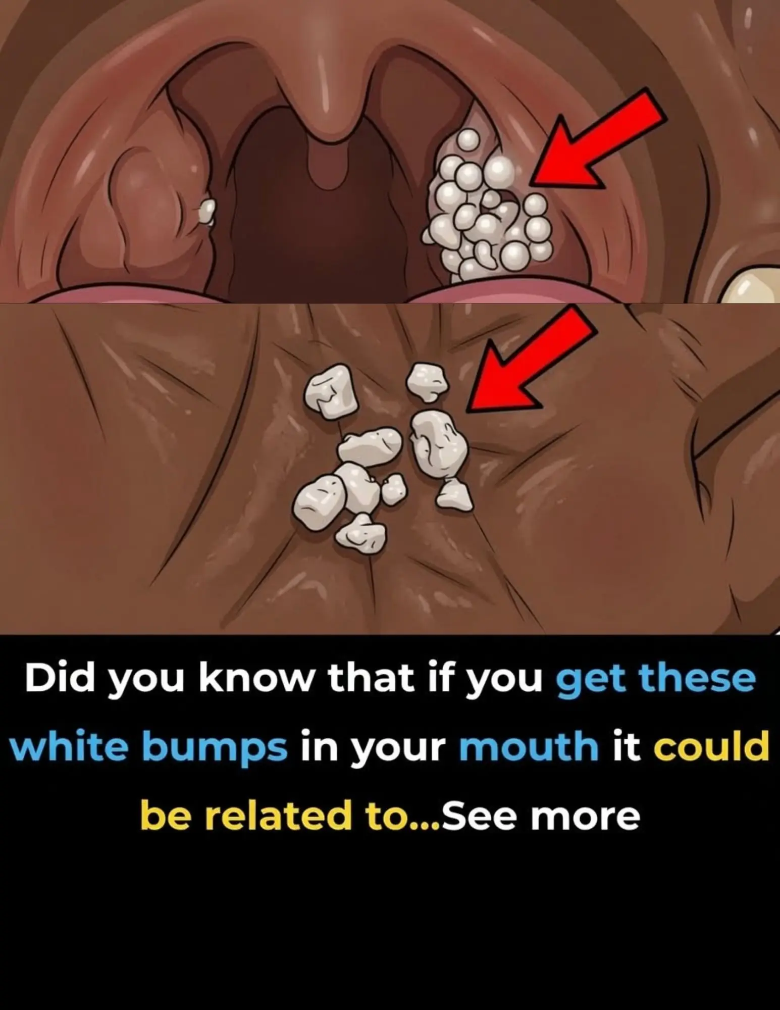 These small mouth symptoms could point to a bigger health problem
