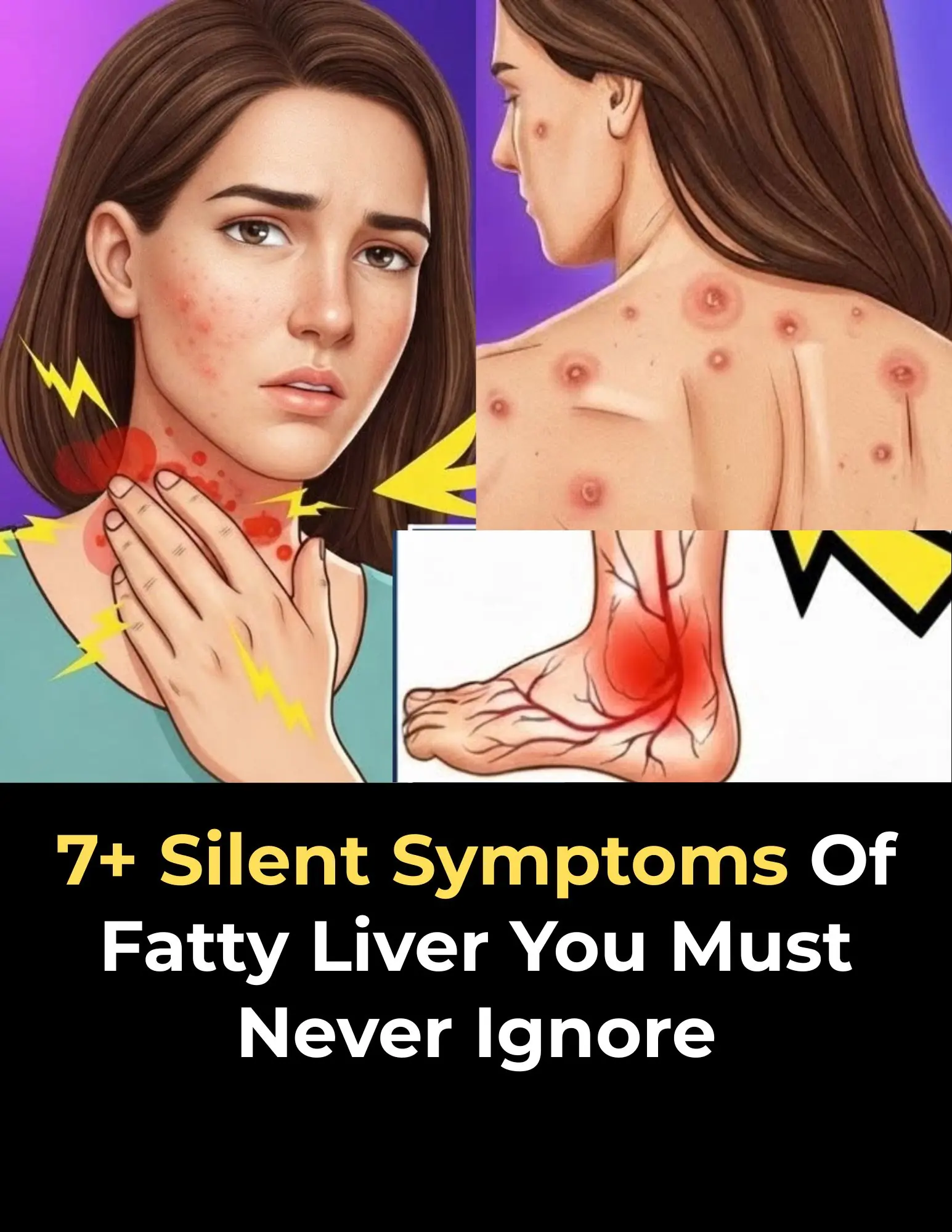 Fatty Liver Disease Explained: Risk Factors, Symptoms, and Evidence-Based Management